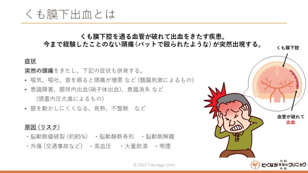 くも膜下出血 の画像イメージ